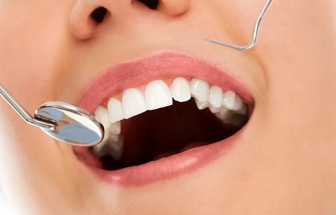 Saúde começa pela boca: Entenda a conexão entre saúde bucal e saúde geral –  Uniodonto Poços de Caldas